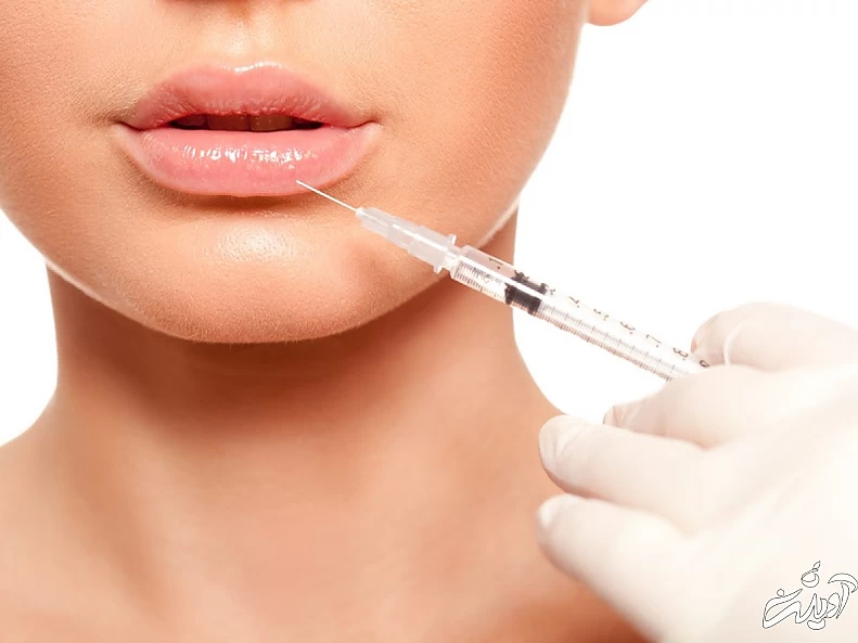 تزریق ژل برای صورت های لاغر